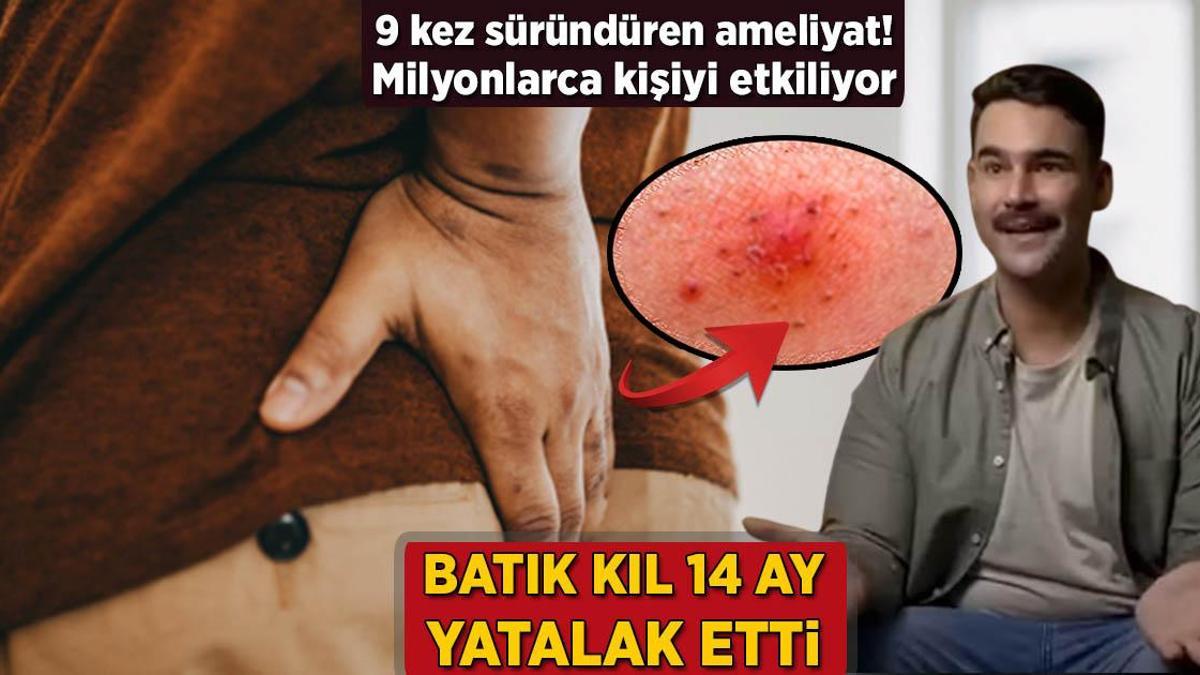 İçeri batan kıl 14 ay yatalak etti! 9 defa süründüren ameliyat, milyonları etkiliyor