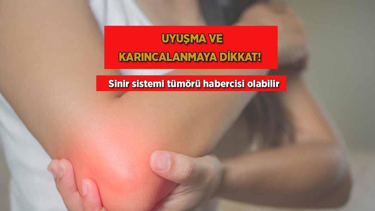 Uyuşma ve karıncalanmaya dikkat! Hudut sistemi tümörü habercisi olabilir